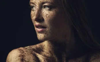 peeling