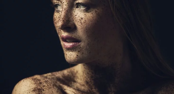 peeling